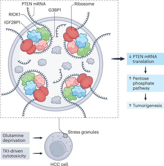 NATURE CANCER Invites Professor Huiyong YIN And Dr. Shanshan ZHONG to Publish “News & Views” On Stress Granules In Liver Cancer
